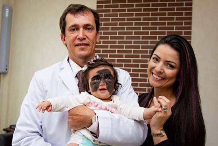 Bebê que nasceu com 'marca do Batman' recebe tratamento de cirurgião russo