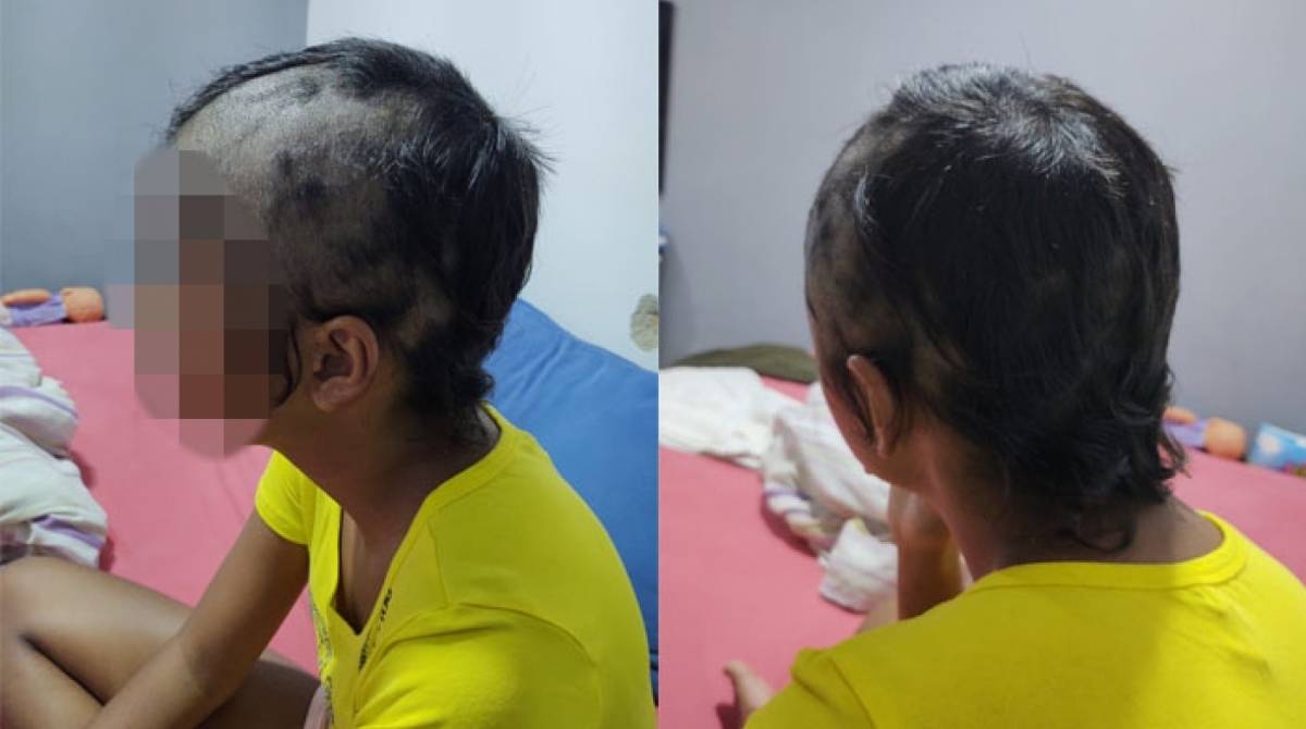 Menina de 14 anos teve o cabelo raspado em acesso de fúria do pai