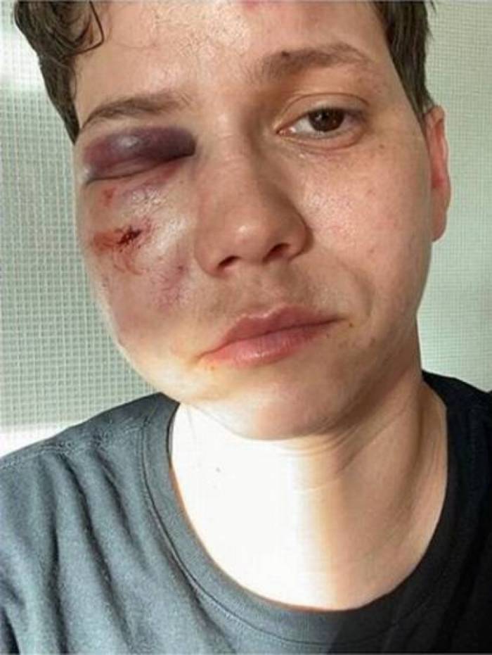 Youtuber homossexual Karol Eller foi agredida na Barra da Tijuca. Ela é apoiadora do governo Bolsonaro