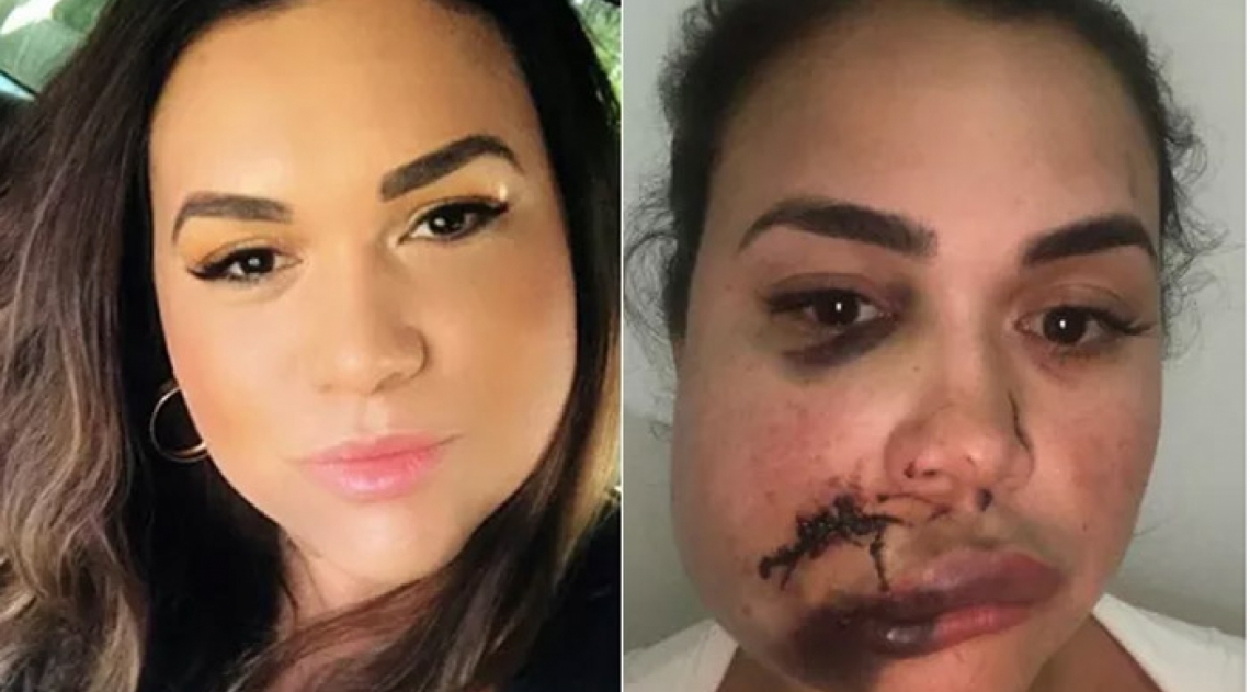 Mika Borges foi agredida dentro de restaurante de luxo em São Paulo - Reprodução Internet