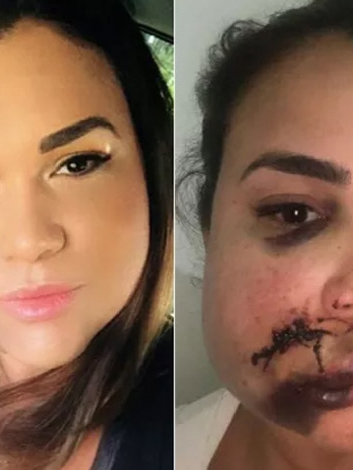 Mika Borges foi agredida dentro de restaurante de luxo em S&atilde;o Paulo