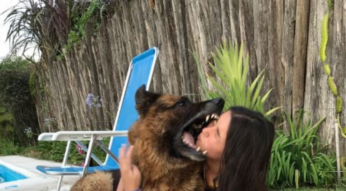 Jovem atacada por cachorro - Reprodução Twitter