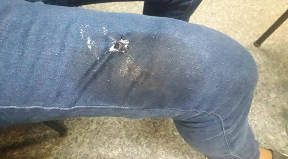 Jovem teve a coxa atingida