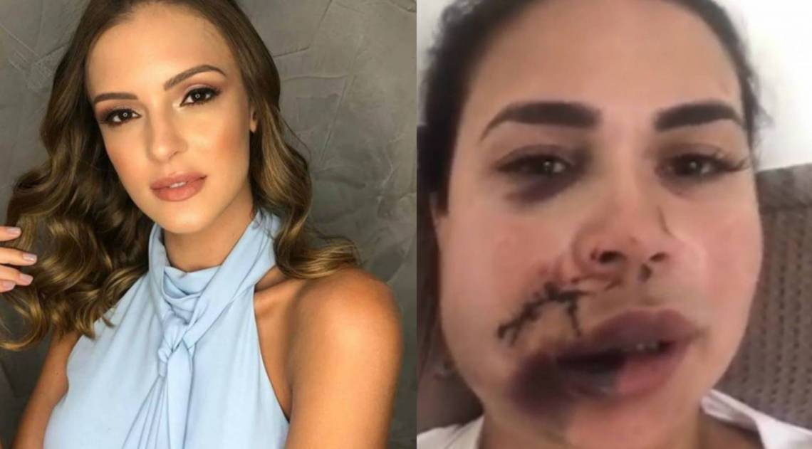 Fernanda Bonito agrediu Milka Borges, no Jockey Club de S&atilde;o Paulo