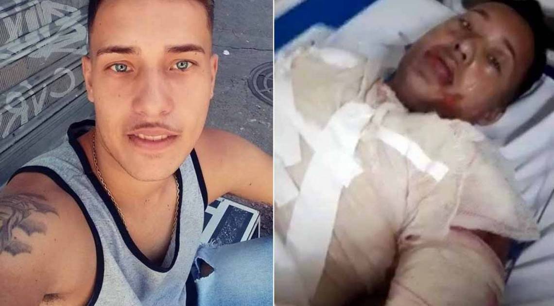 Daniel Jean teve 60% do corpo queimado - Arquivo Pessoal