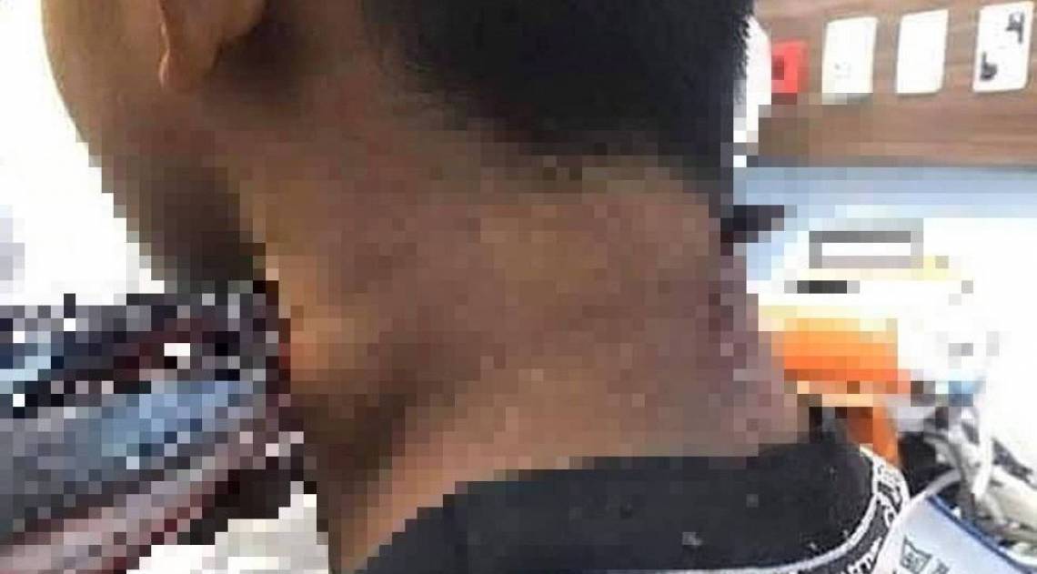 Jovem indonÃ©sio Ã© atacado por peixe-agulha enquanto pescava com os pais - ReproduÃ§Ã£o