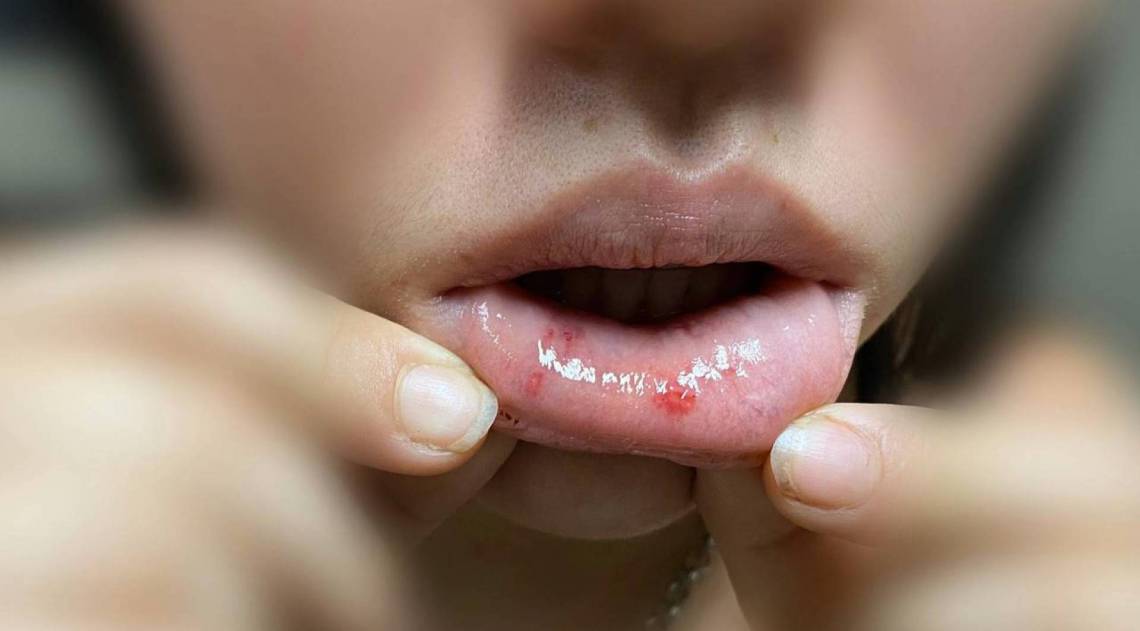 Agressões aconteceram no início da manhã desta terça-feira