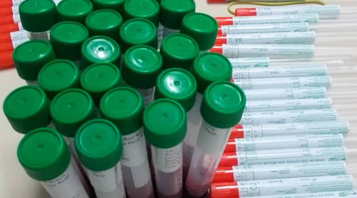 A Vigilância em Saúde de Campos recebeu 30 kits para testes de coronavírus do governo estadual; restam 12 deles - Divulgação prefeitura de Campos
