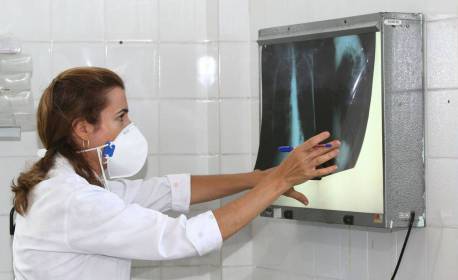 Caxias promove ações de prevenção e combate contra tuberculose