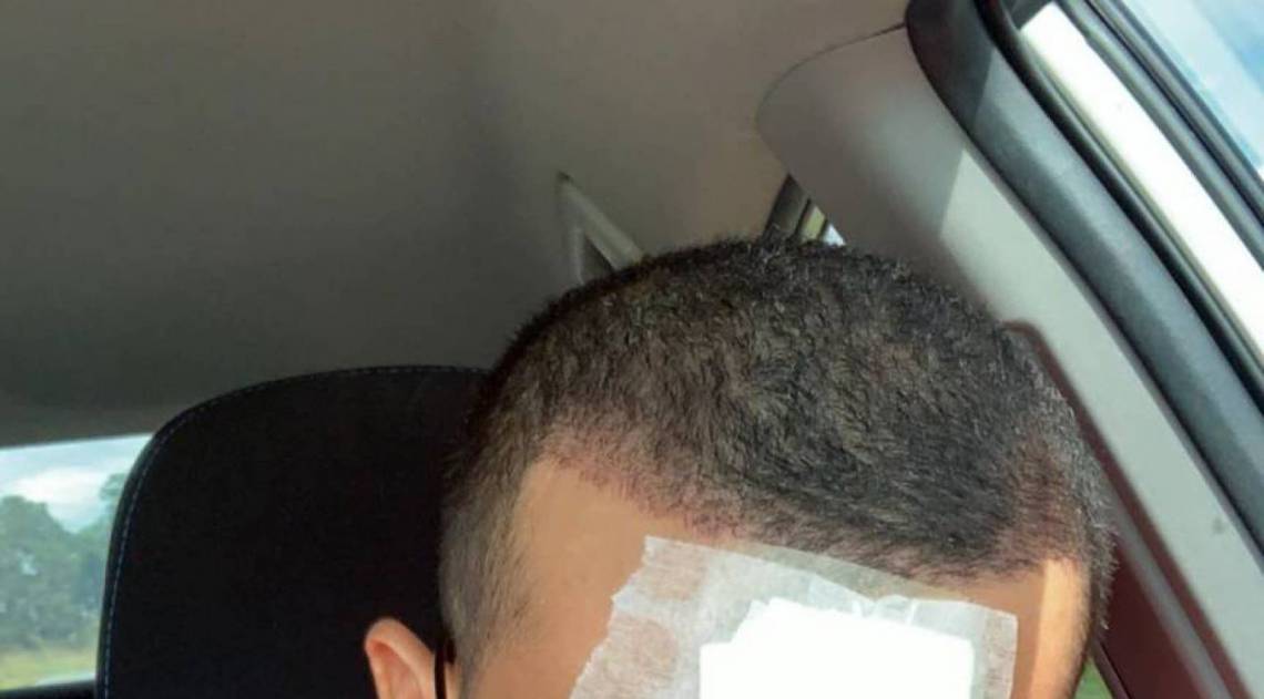 Israel Novaes se machuca - Reprodução de internet