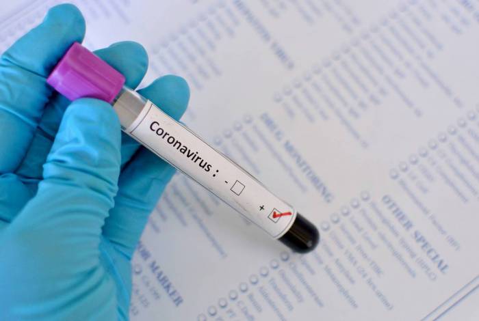Ainda não há vacina contra o coronavírus 