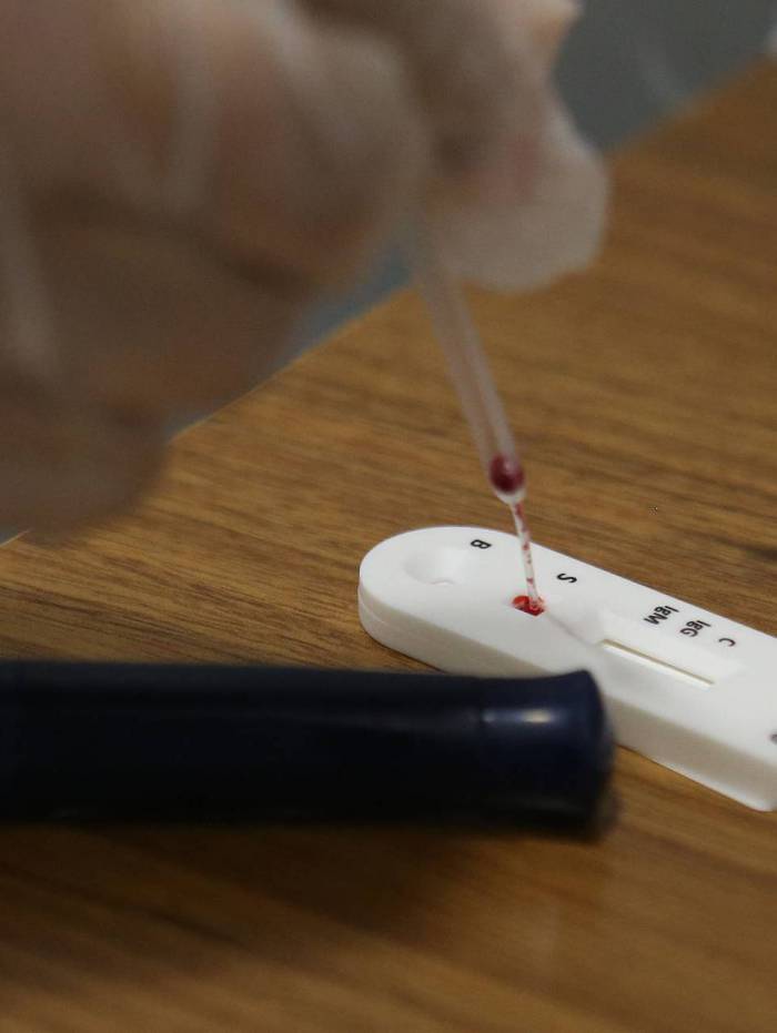 Testes em farmácias somente na presença de farmacêutico