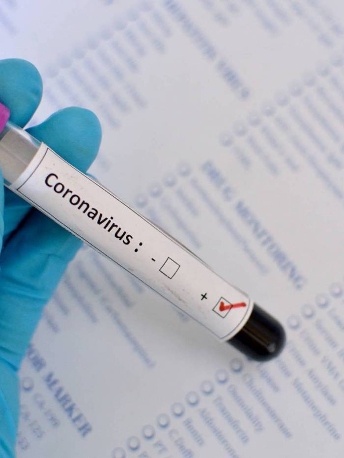 Fran&ccedil;a se aproxima de 20 mil mortes