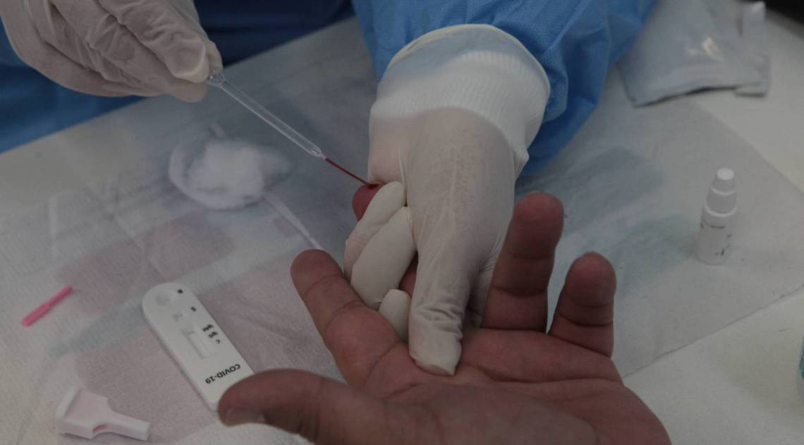 Niter&oacute;i vai aplicar 50 mil testes para covid-19