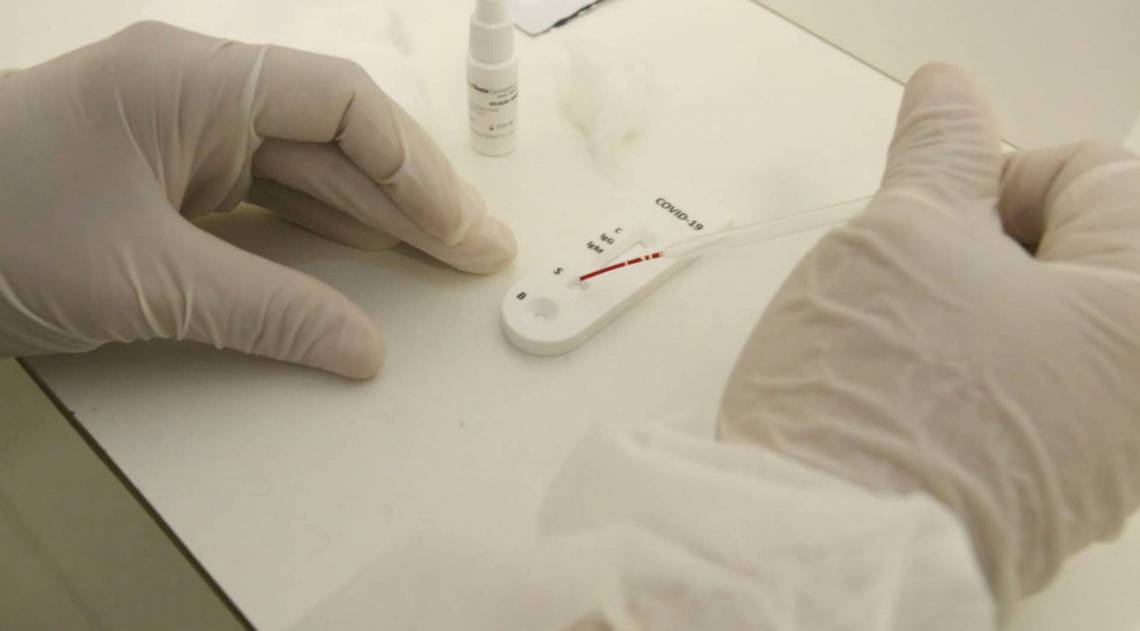 Prefeitura de Niterói recebe os 50 mil testes que serão aplicados na cidade - fotos Divulgação/Luciana Carneiro