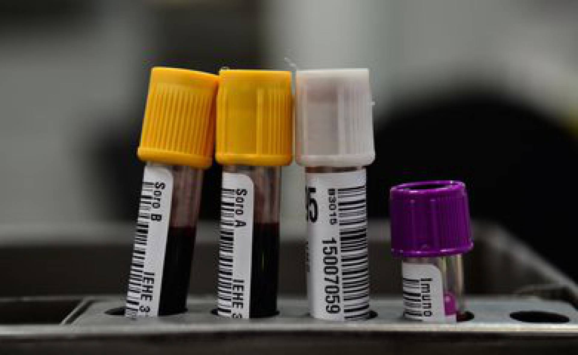 Hemorio inicia testes com plasma sangu&iacute;neo em pacientes com covid-19