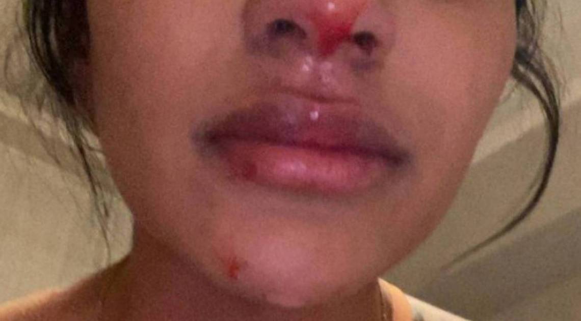 Namorada de Sebastián Villa o acusa de agressão - Reprodução