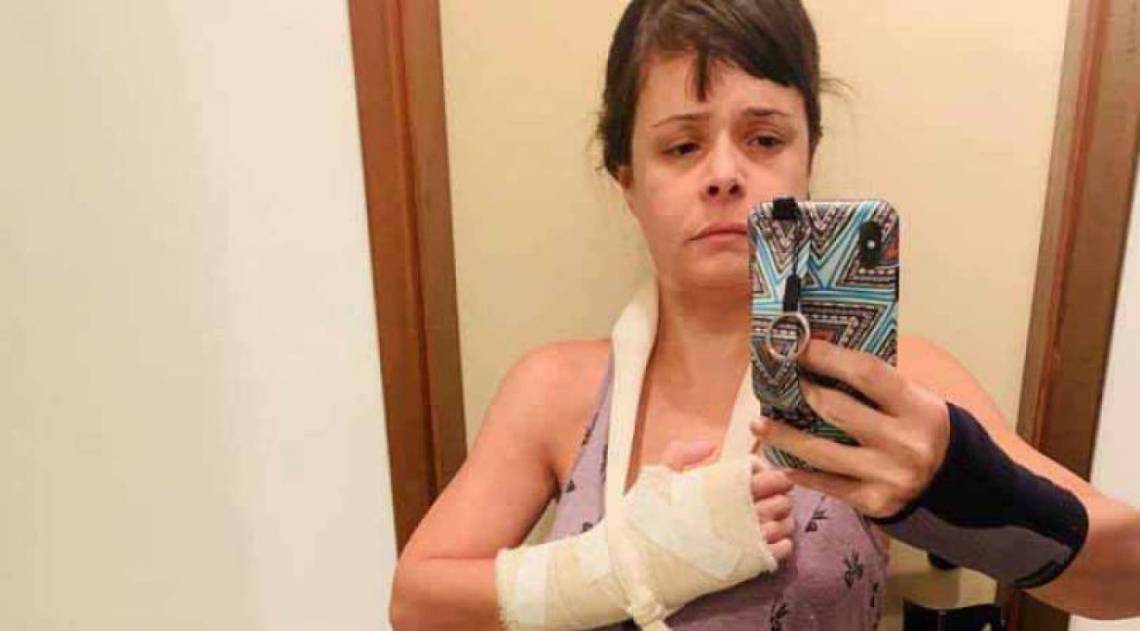 M&eacute;dica ficou com marcas das agress&otilde;es espalhadas pelo corpo