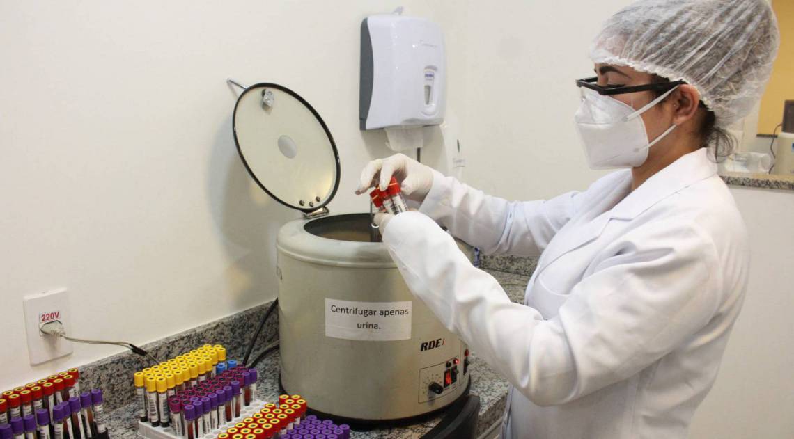 São João reabre novo laboratório central com equipamentos de ponta - Divulgação