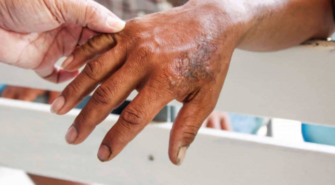 Casa Amarela muda de endereço e atendimento já está sendo realizado no novo local - Reprodução da Internet