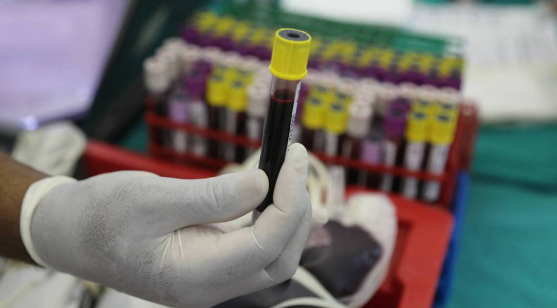 Doação de sangue Queimados