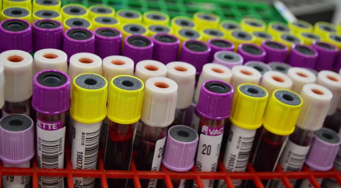 Doação de sangue Queimados