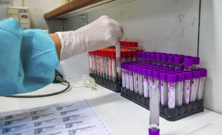 Pesquisadores criam fármacos para combater covid-19