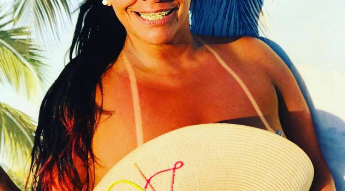 MC Atrevida fez lipoescultura