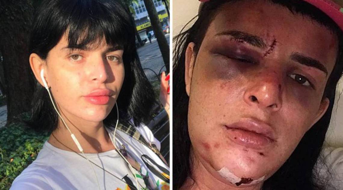 Alice Ferris recebeu apoio de famosos após ser espancada dentro de casa - Reprodução