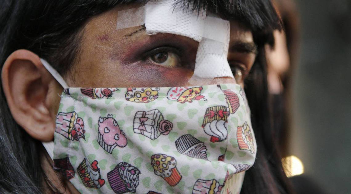 Rio de Janeiro - RJ  - 20/08/2020 - Policia - Policia prende acusado de agradir a modelo trnas Alice Felis - na foto, Alice Felis -  Foto Reginaldo Pimenta / Agencia O Dia