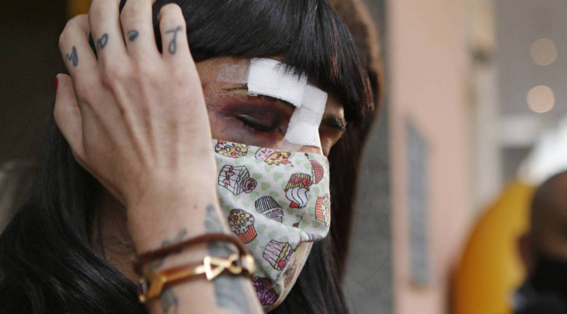 Rio de Janeiro - RJ  - 20/08/2020 - Policia - Policia prende acusado de agradir a modelo trnas Alice Felis - na foto, Alice Felis -  Foto Reginaldo Pimenta / Agencia O Dia