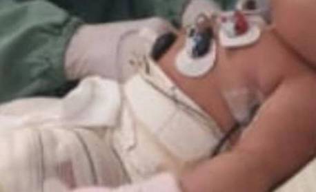 Enfermeiras envolvidas em morte de bebê de seis meses que teve corpo queimado são indiciadas pela polícia