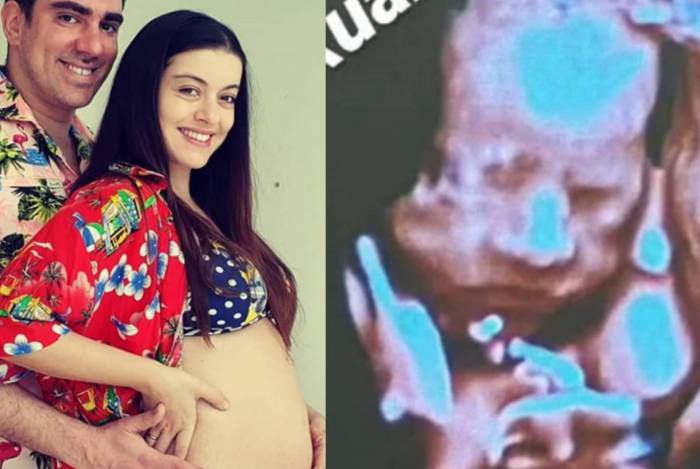 Mulher de Marcelo Adnet exibe rostinho de filha em ultrassom - Reprodução Instagram
