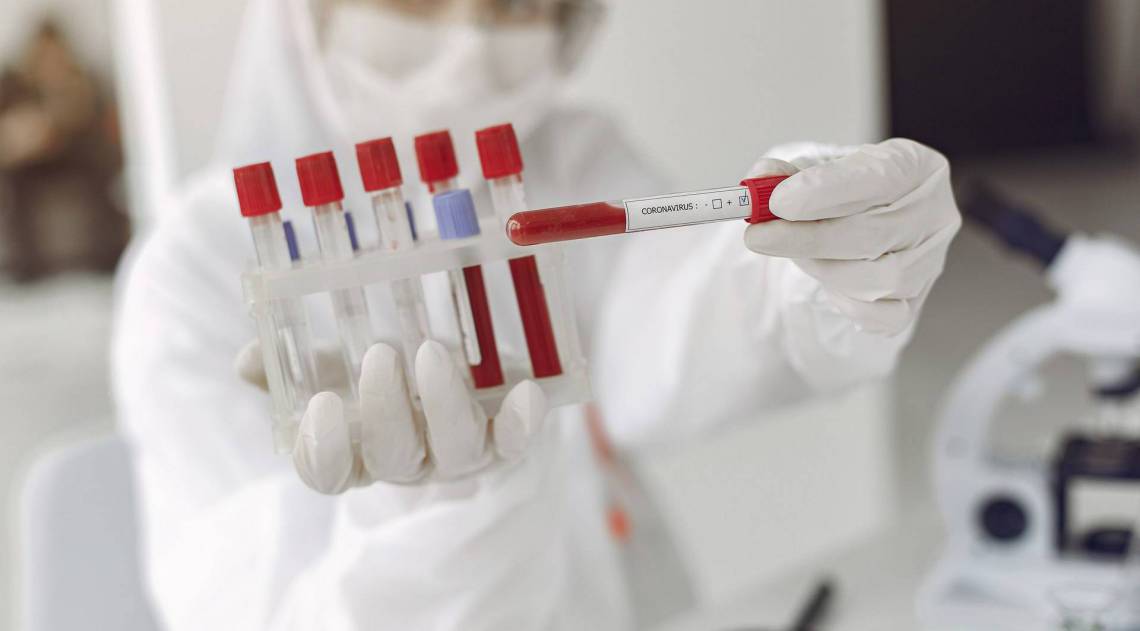 Hong Kong registra casos de reinfecção da covid-19 - FreePick/Divulgação