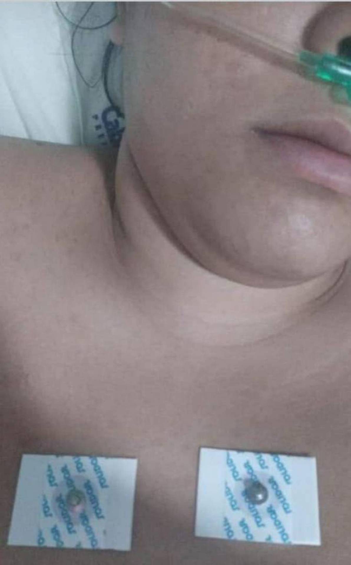 Funcion&aacute;ria da Sa&uacute;de de Cabo Frio pega Covid-19 no trabalho e &eacute; demitida  