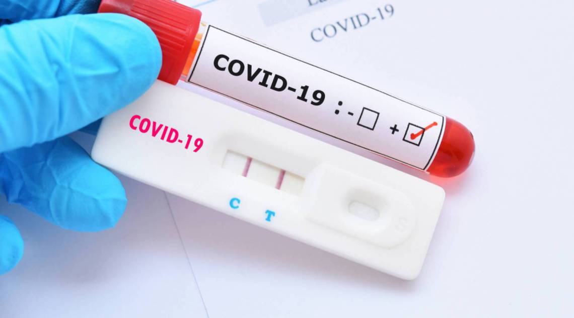  Covid-19 - Divulga&ccedil;&atilde;o