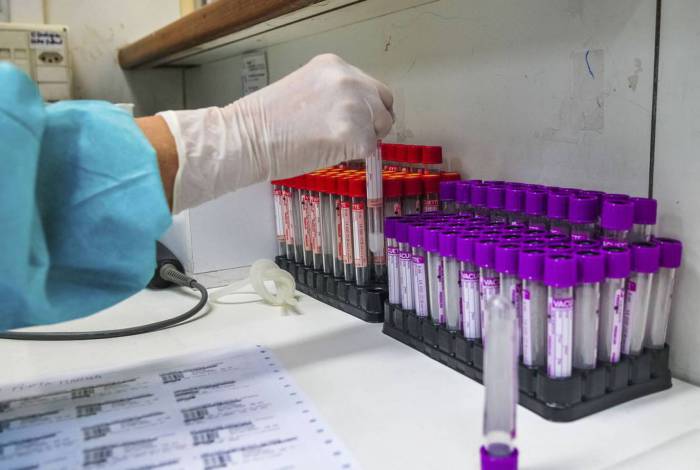 Objetivo da pesquisa é tornar o teste mais acessível à população