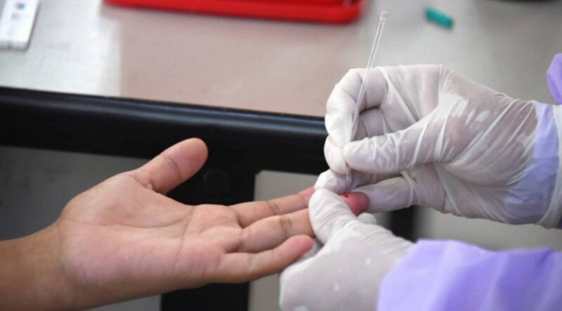 Vírus está ativo em 33 pessoas que testaram positivo; 67 moradores aguardam confirmação - Foto: Ilustrativa