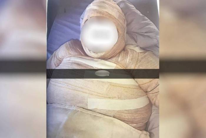 Mulher é presa suspeita de atear fogo na namorada após discussão por ciúmes