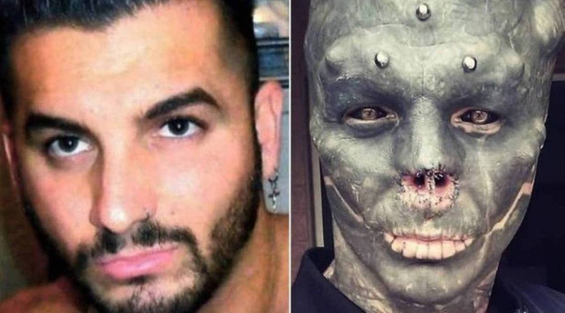 A transformação de Anthony Loffredo - Reprodução