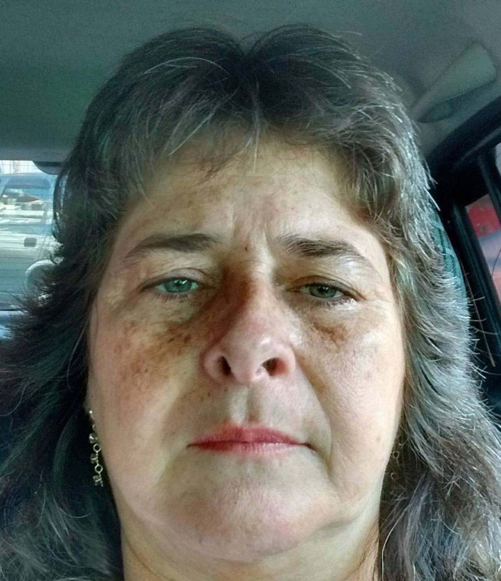 Val&eacute;ria Vieira da Veiga est&aacute; internada no Hospital Alberto Torres - Reprodu&ccedil;&atilde;o / Facebook