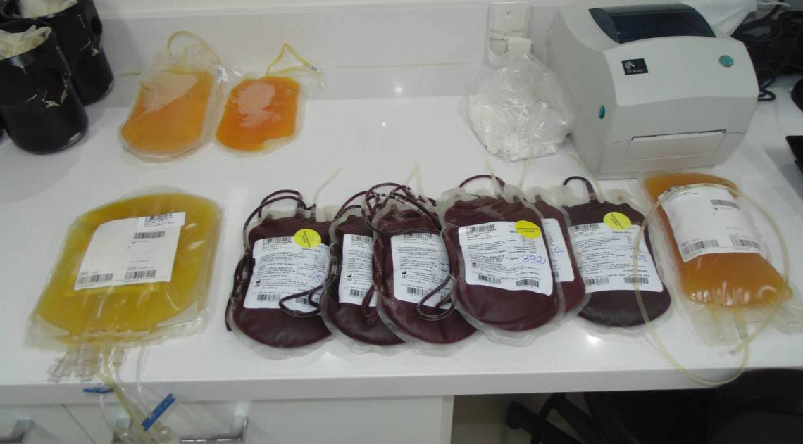 Bolsas com hemocomponentes, separados pelo banco de sangue após uma doação - Marco Antonio Pereira
