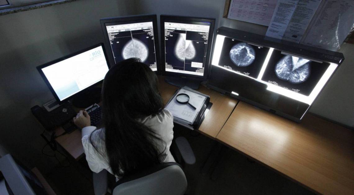 Rio Imagem oferece mamografia gratuita em todo o mês de outubro

 - Divulgação