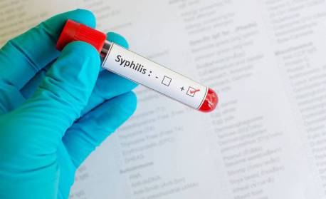 Brasil tem 783 mil casos de sífilis em uma década, aponta pesquisa