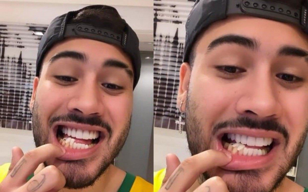 Kevinho quebra lentes provis&oacute;rias dos dentes