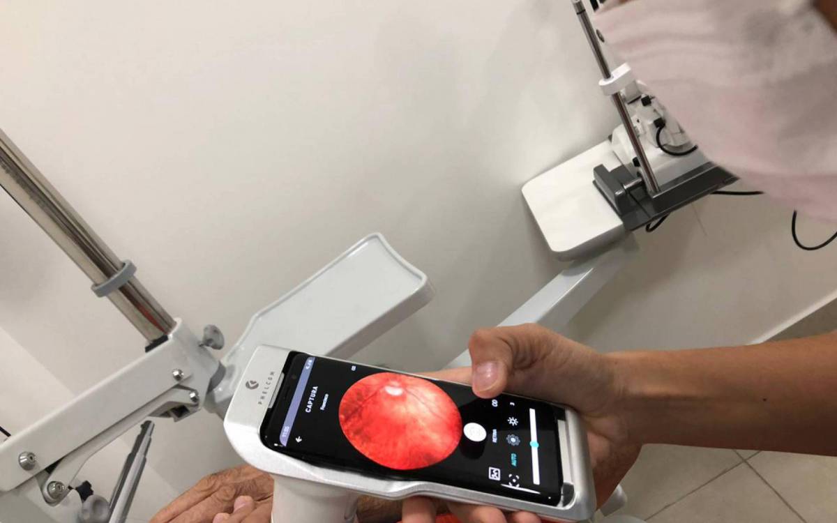 Imagens capturadas serão enviadas para análise à distância do médico oftalmologista 