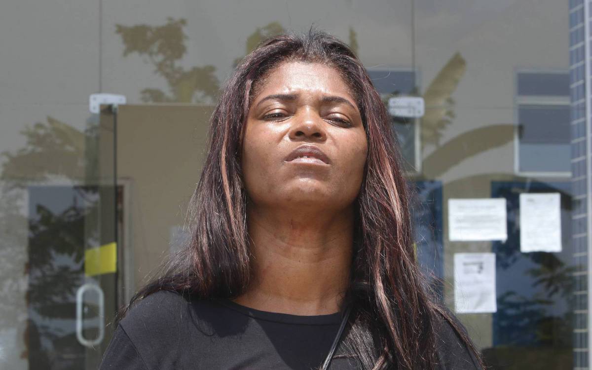 Ana Maria de Souza mostra marcas da agressão sofrida - REGINALDO PIMENTA