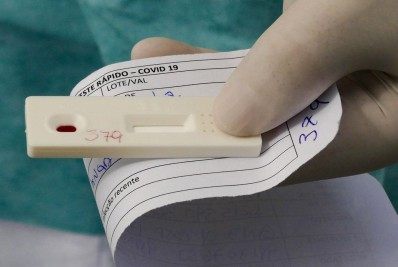 Brasil se aproxima das 570 mil mortes por Covid, aponta Conass