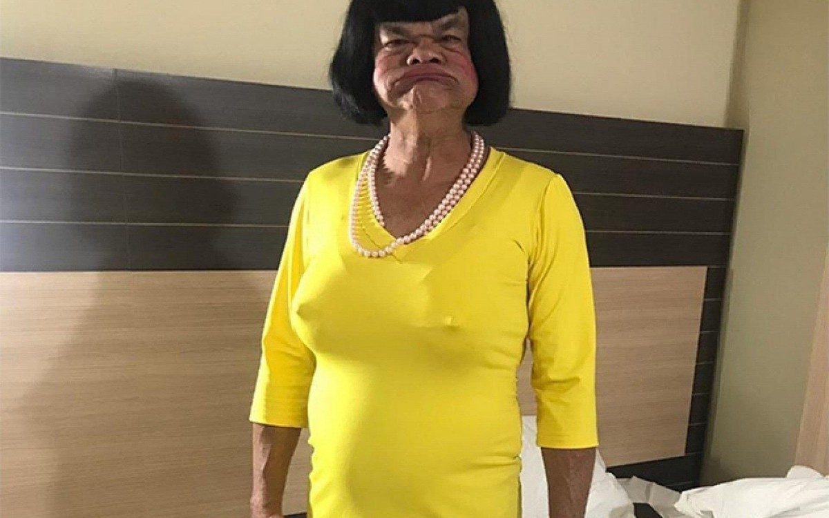 Rodela est&aacute; com 95% do pulm&atilde;o comprometido - Reprodu&ccedil;&atilde;o Internet