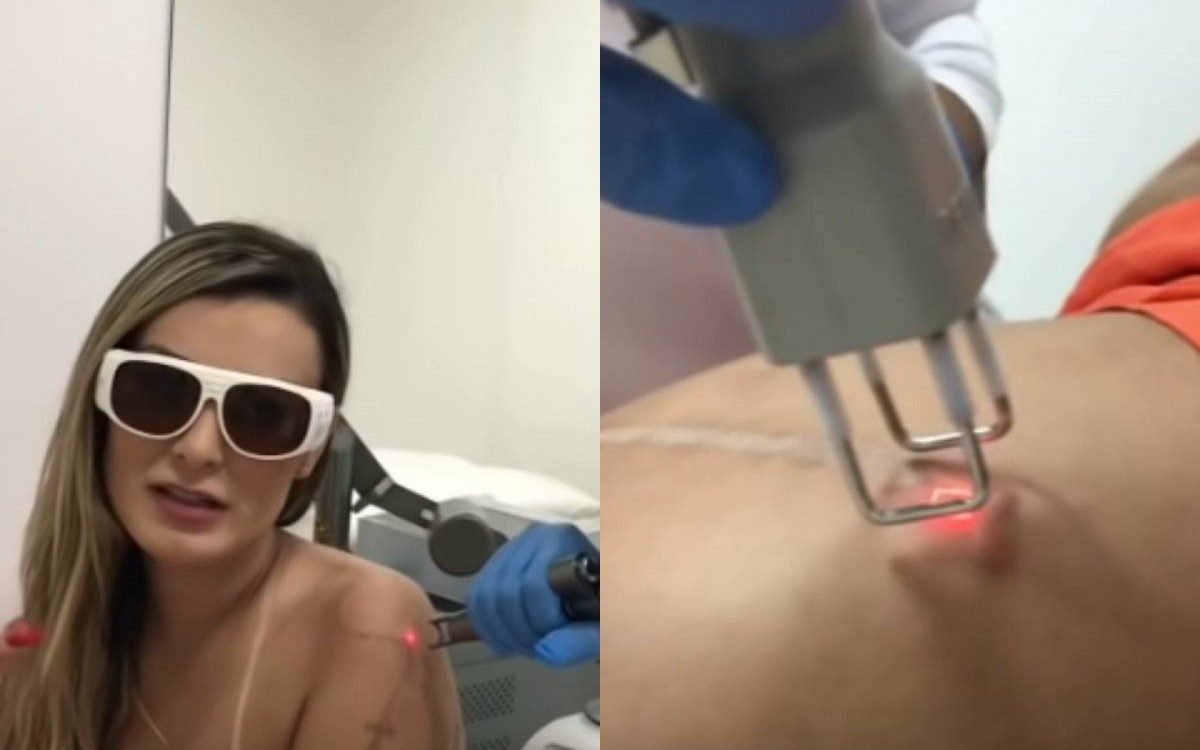 Andressa Urach remove tatuagens e cicatriz no bumbum - Reprodu&ccedil;&atilde;o Internet